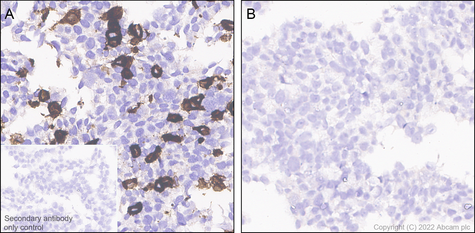 Immunohistochemistry (Formalin/PFA-fixed paraffin-embedded sections) - Anti-CLEC9A antibody [EPR24271-117] (AB300433)