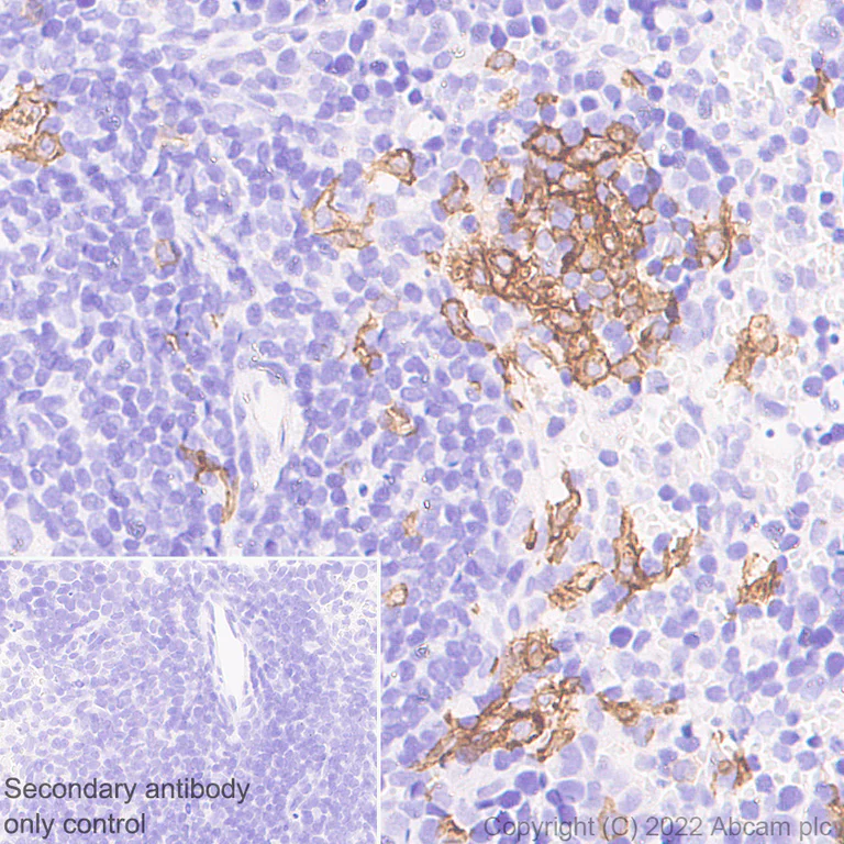 Immunohistochemistry (Formalin/PFA-fixed paraffin-embedded sections) - Anti-CLEC9A antibody [EPR24271-117] (BSA and Azide free) (AB300434)