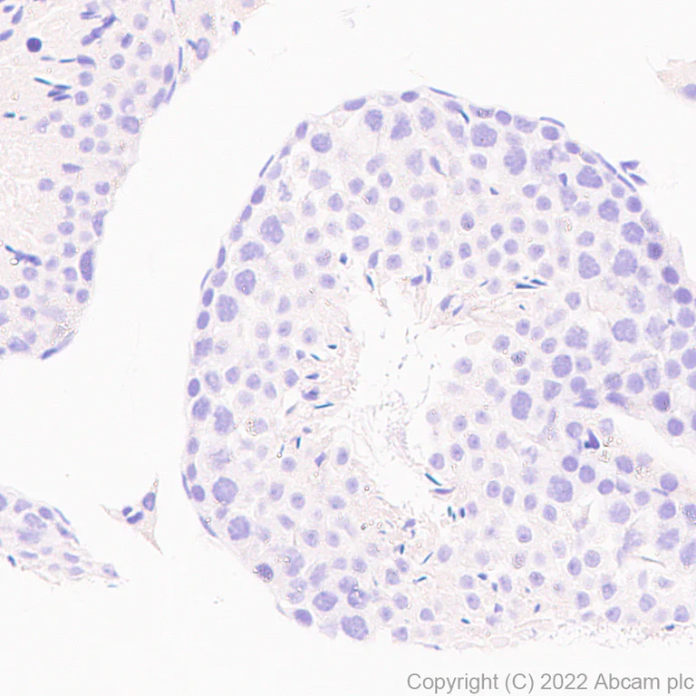 Immunohistochemistry (Formalin/PFA-fixed paraffin-embedded sections) - Anti-CLEC9A antibody [EPR24271-117] (BSA and Azide free) (AB300434)