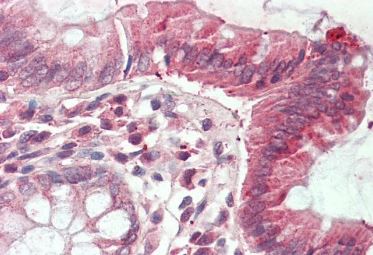 Immunohistochemistry (Formalin/PFA-fixed paraffin-embedded sections) - Anti-CLIC1 antibody (AB219265)