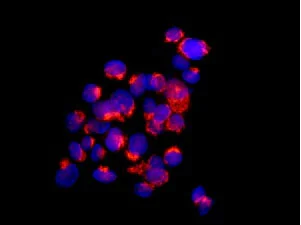 Immunocytochemistry/ Immunofluorescence - Anti-CLIC2 antibody [EPR6494] - BSA and Azide free (AB249880)
