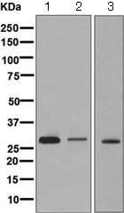 Western blot - Anti-CLIC2 antibody [EPR6495] (AB126727)