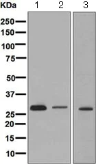 Western blot - Anti-CLIC2 antibody [EPR6495] (AB126727)