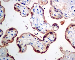 Immunohistochemistry (Formalin/PFA-fixed paraffin-embedded sections) - Anti-CLIC3 antibody [EPR8243(B)] (AB128941)