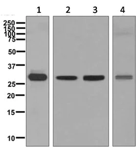 Western blot - Anti-CLIC3 antibody [EPR8244(B)] (AB129186)