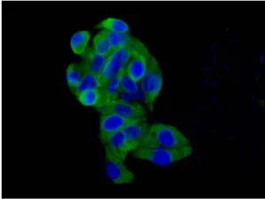 Immunocytochemistry/ Immunofluorescence - Anti-CLIC4 antibody [EPR14253] (AB183043)
