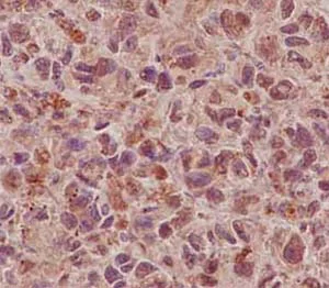 Immunohistochemistry (Formalin/PFA-fixed paraffin-embedded sections) - Anti-CLIC4 antibody [EPR14253] - BSA and Azide free (AB236130)