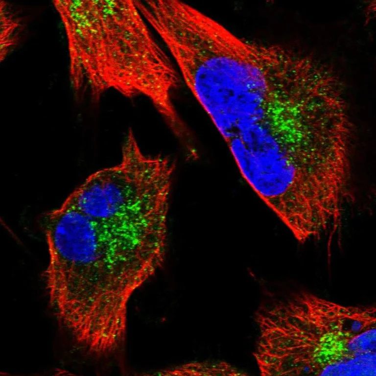 Immunocytochemistry/ Immunofluorescence - Anti-CLINT1 antibody (AB251892)