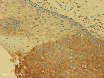 Immunohistochemistry (Formalin/PFA-fixed paraffin-embedded sections) - Anti-CLIP170 antibody [mAbcam61830] (AB61830)