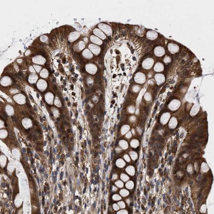 Immunohistochemistry (Formalin/PFA-fixed paraffin-embedded sections) - Anti-CLIP2 antibody (AB224111), expandable thumbnail