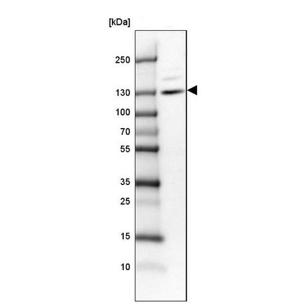 Western blot - Anti-CLIP2 antibody (AB224111), expandable thumbnail