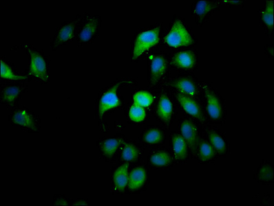 Immunocytochemistry/ Immunofluorescence - Anti-CLIP2 antibody (AB236993)