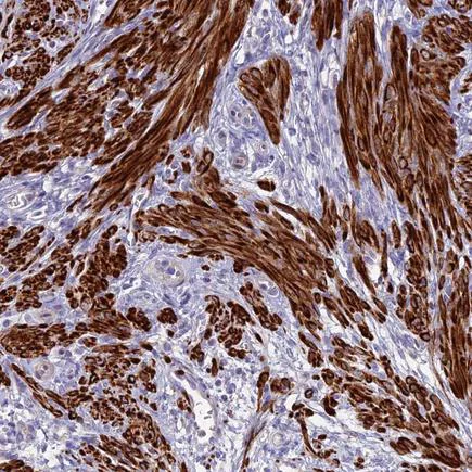 Immunohistochemistry (Formalin/PFA-fixed paraffin-embedded sections) - Anti-CLIP4 antibody (AB243532)