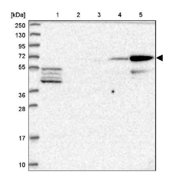 Western blot - Anti-CLIP4 antibody (AB243532)