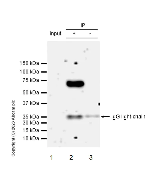 Immunoprecipitation - Anti-CLIPR-59 antibody [EPR28002-60] (AB312846)