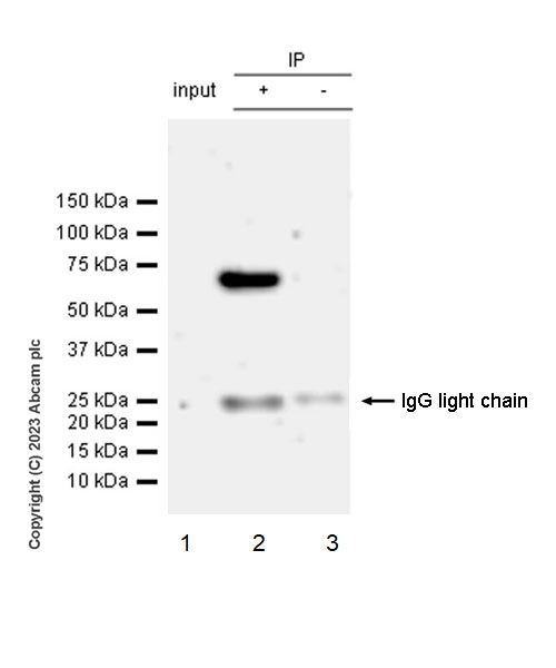 Immunoprecipitation - Anti-CLIPR-59 antibody [EPR28002-60] (AB312846)