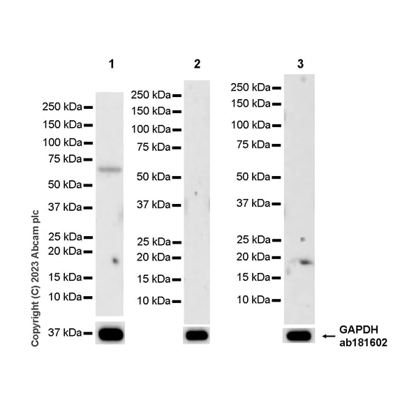 Western blot - Anti-CLIPR-59 antibody [EPR28002-60] (AB312846)