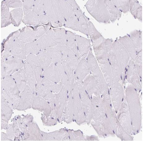 Immunohistochemistry (Formalin/PFA-fixed paraffin-embedded sections) - Anti-CLK2 antibody (AB188141)
