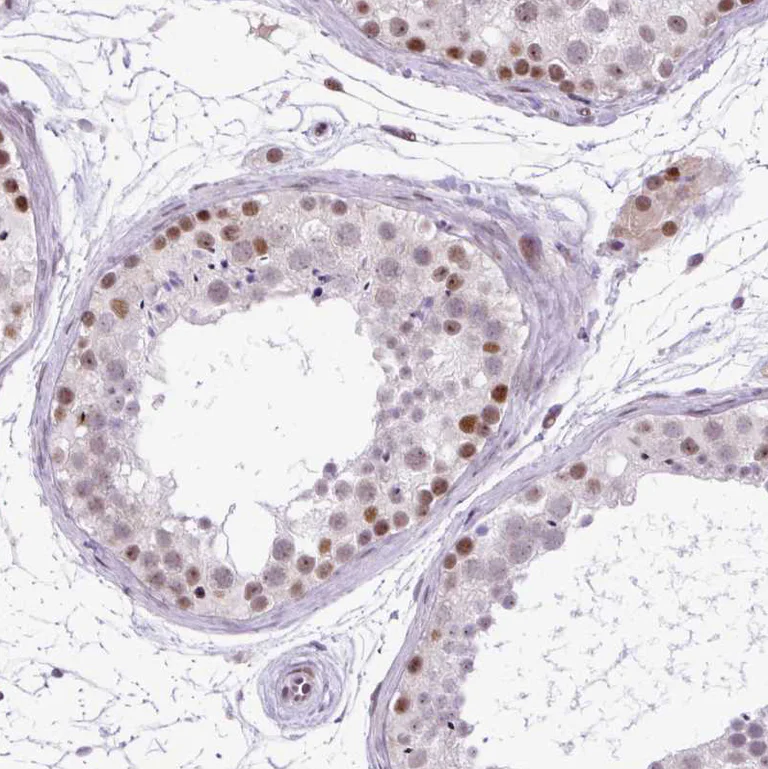 Immunohistochemistry (Formalin/PFA-fixed paraffin-embedded sections) - Anti-CLK2 antibody (AB188141)