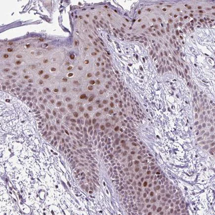Immunohistochemistry (Formalin/PFA-fixed paraffin-embedded sections) - Anti-CLK2 antibody (AB188141)