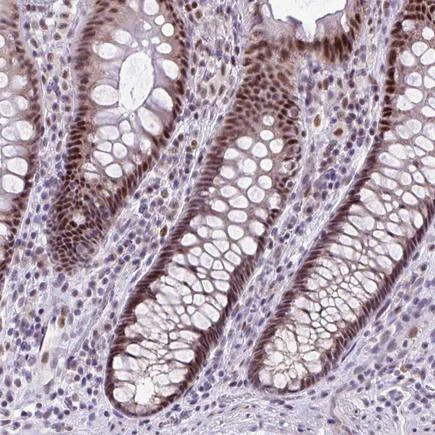 Immunohistochemistry (Formalin/PFA-fixed paraffin-embedded sections) - Anti-CLK2 antibody (AB188141)
