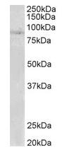 Western blot - Anti-CLLD8/SETDB2 antibody (AB133174)