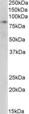 Western blot - Anti-CLLD8/SETDB2 antibody (AB13712), expandable thumbnail