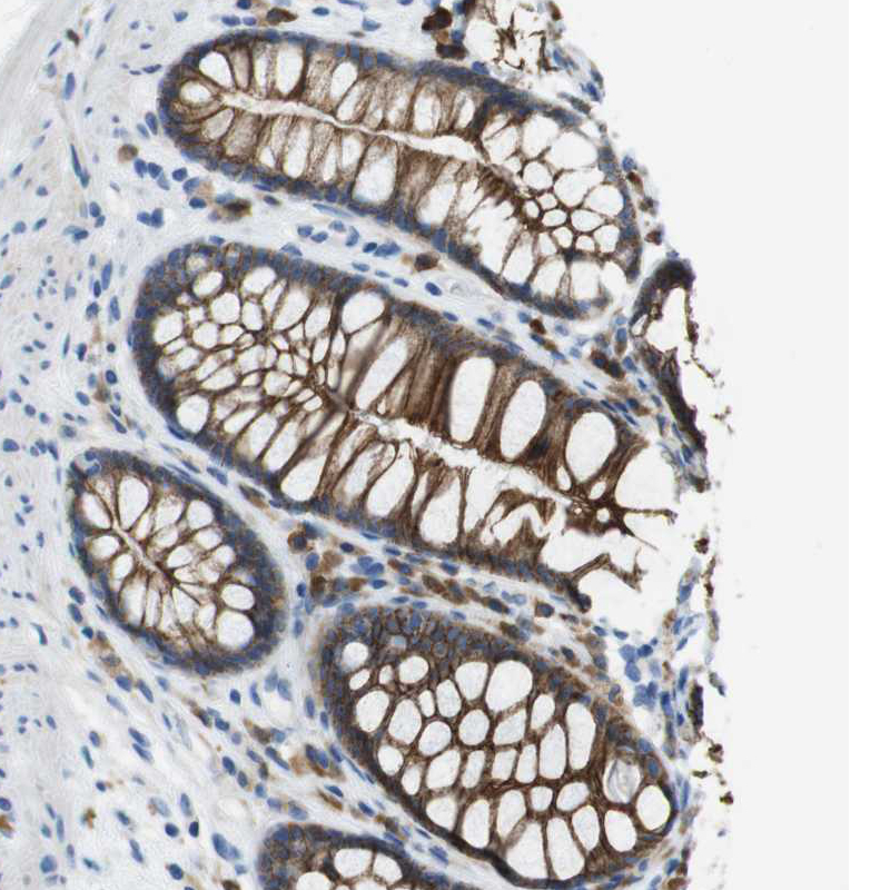 Immunohistochemistry (Formalin/PFA-fixed paraffin-embedded sections) - Anti-CLMN antibody (AB121373), expandable thumbnail