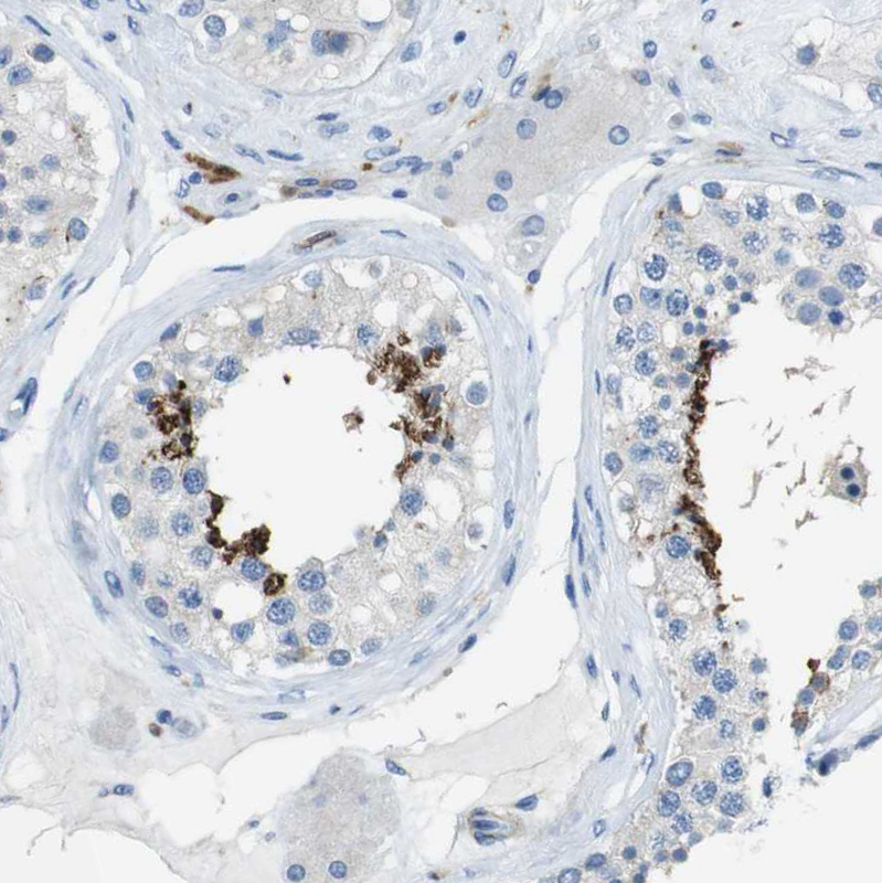 Immunohistochemistry (Formalin/PFA-fixed paraffin-embedded sections) - Anti-CLMN antibody (AB121373), expandable thumbnail