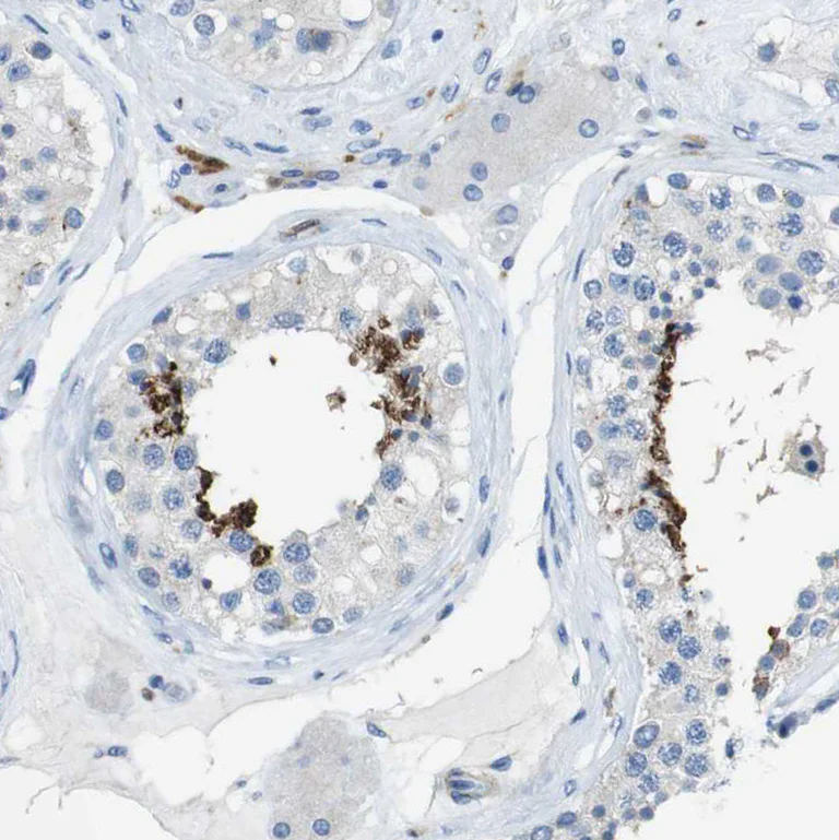 Immunohistochemistry (Formalin/PFA-fixed paraffin-embedded sections) - Anti-CLMN antibody (AB121373)
