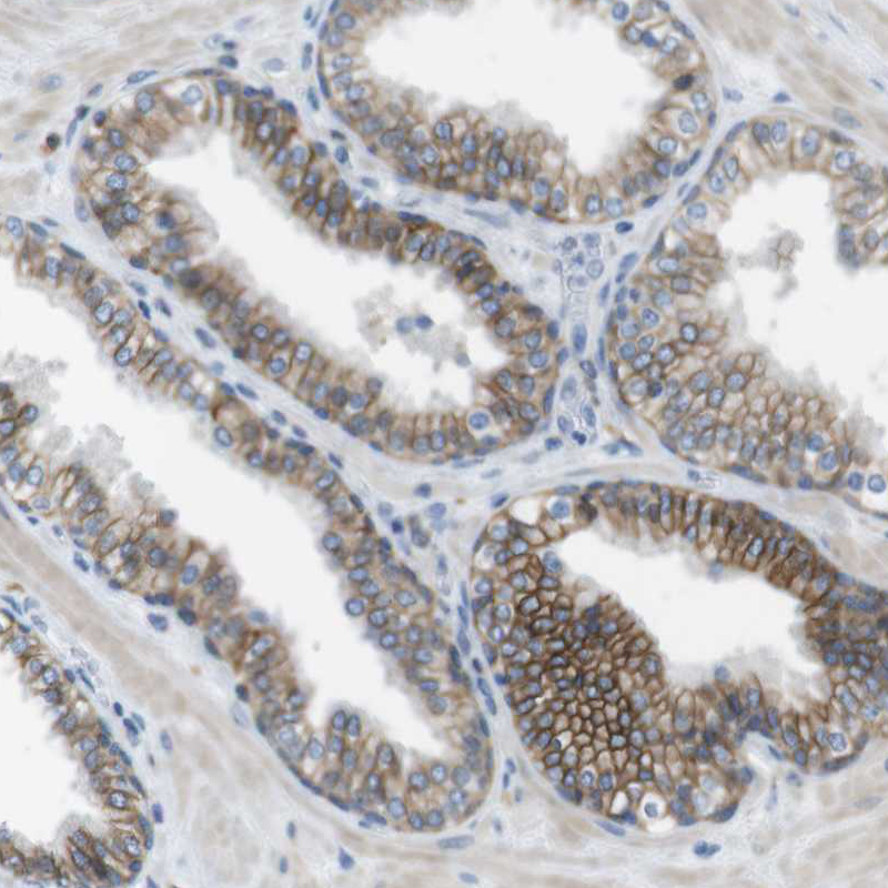 Immunohistochemistry (Formalin/PFA-fixed paraffin-embedded sections) - Anti-CLMN antibody (AB121373), expandable thumbnail