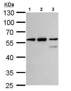 Western blot - Anti-CLN3 antibody (AB227592)