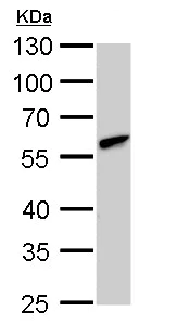 Western blot - Anti-CLN3 antibody (AB227592)