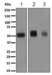 Western blot - Anti-CLN5 antibody [EPR12197(B)] (AB170899)