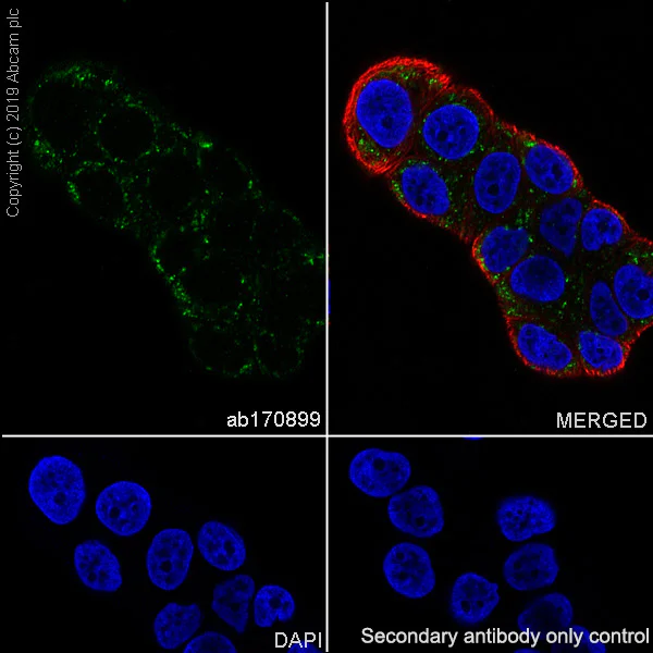 Immunocytochemistry/ Immunofluorescence - Anti-CLN5 antibody [EPR12197(B)] - BSA and Azide free (AB238931)