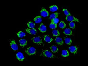 Immunocytochemistry/ Immunofluorescence - Anti-CLN5 antibody [EPR12197(B)] - BSA and Azide free (AB238931)