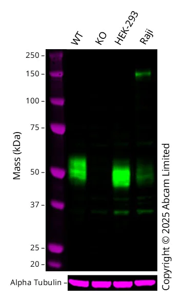 Western blot - Anti-CLN5 antibody [EPR12197(B)] - BSA and Azide free (AB238931)