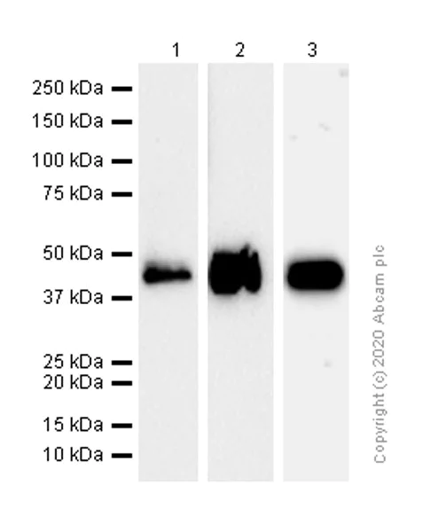 Western blot - Anti-CLN5 antibody [EPR12197(B)] - BSA and Azide free (AB238931)