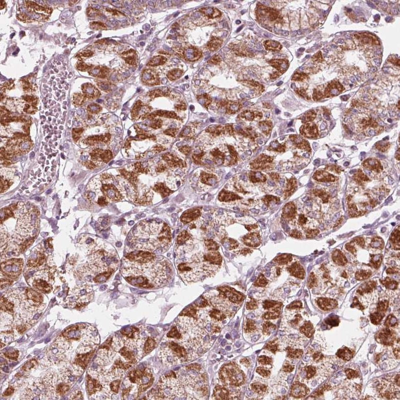 Immunohistochemistry (Formalin/PFA-fixed paraffin-embedded sections) - Anti-CLN6 antibody (AB272678)