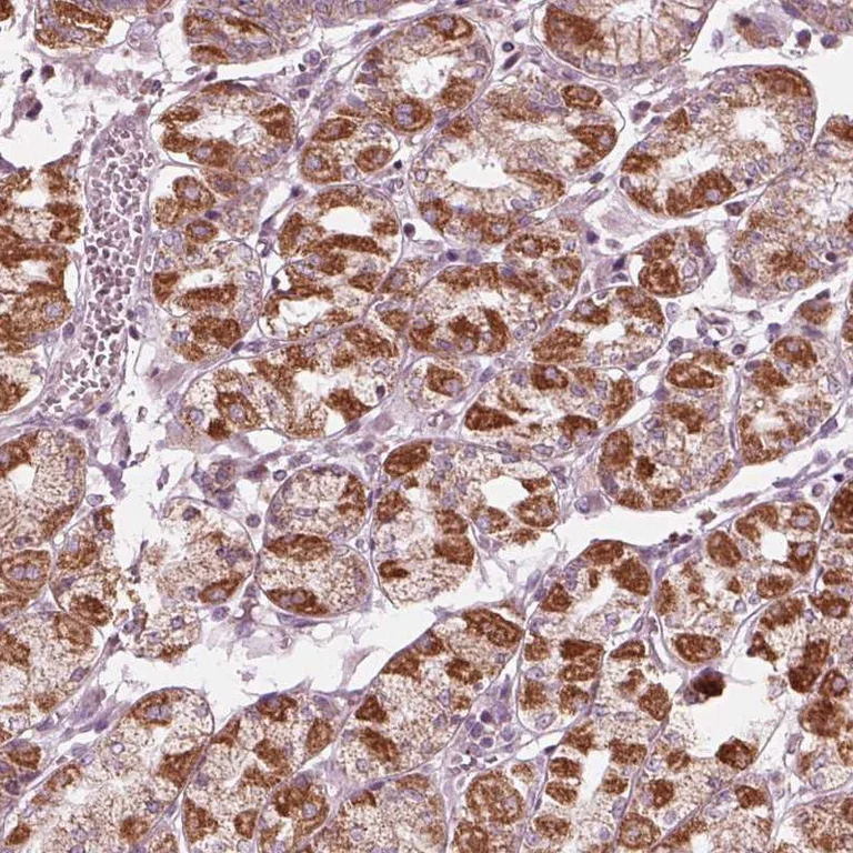 Immunohistochemistry (Formalin/PFA-fixed paraffin-embedded sections) - Anti-CLN6 antibody (AB272678)