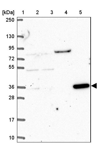 Western blot - Anti-CLN6 antibody (AB272678)