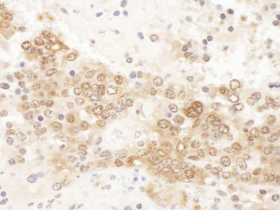 Immunohistochemistry (Formalin/PFA-fixed paraffin-embedded sections) - Anti-CLNS1A/CLCI antibody - C-terminal (AB192907)