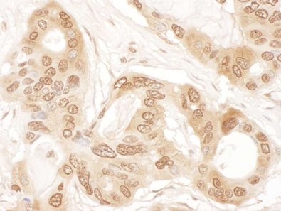 Immunohistochemistry (Formalin/PFA-fixed paraffin-embedded sections) - Anti-CLNS1A/CLCI antibody - C-terminal (AB192907)