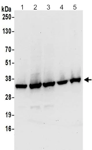 Western blot - Anti-CLNS1A/CLCI antibody - C-terminal (AB192907)