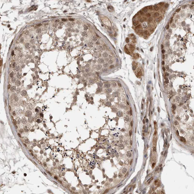 Immunohistochemistry (Formalin/PFA-fixed paraffin-embedded sections) - Anti-CLOCK Antibody (AB327210)