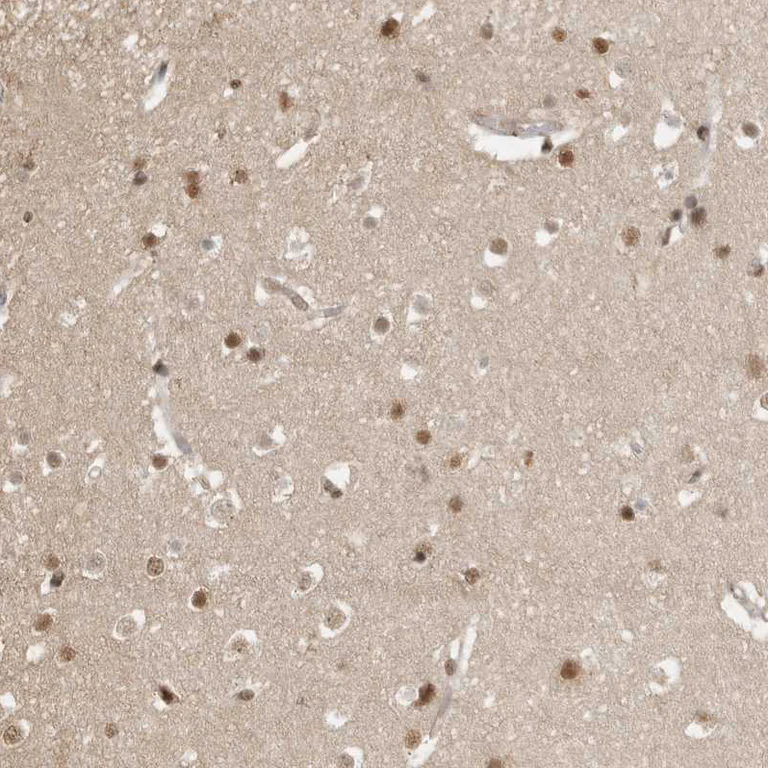 Immunohistochemistry (Formalin/PFA-fixed paraffin-embedded sections) - Anti-CLOCK Antibody (AB327210)