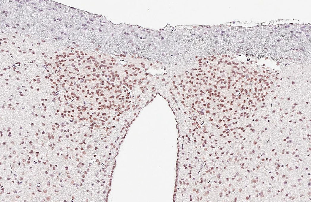 Immunohistochemistry (Formalin/PFA-fixed paraffin-embedded sections) - Anti-CLOCK antibody [HL1099] (AB308571)