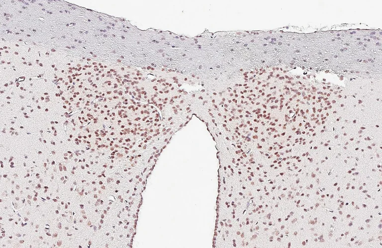 Immunohistochemistry (Formalin/PFA-fixed paraffin-embedded sections) - Anti-CLOCK antibody [HL1099] (AB308571)