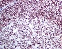 Immunohistochemistry (Formalin/PFA-fixed paraffin-embedded sections) - Anti-CLP1 antibody [EPR7180(2)] (AB133669)