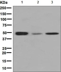 Western blot - Anti-CLP1 antibody [EPR7180(2)] (AB133669)